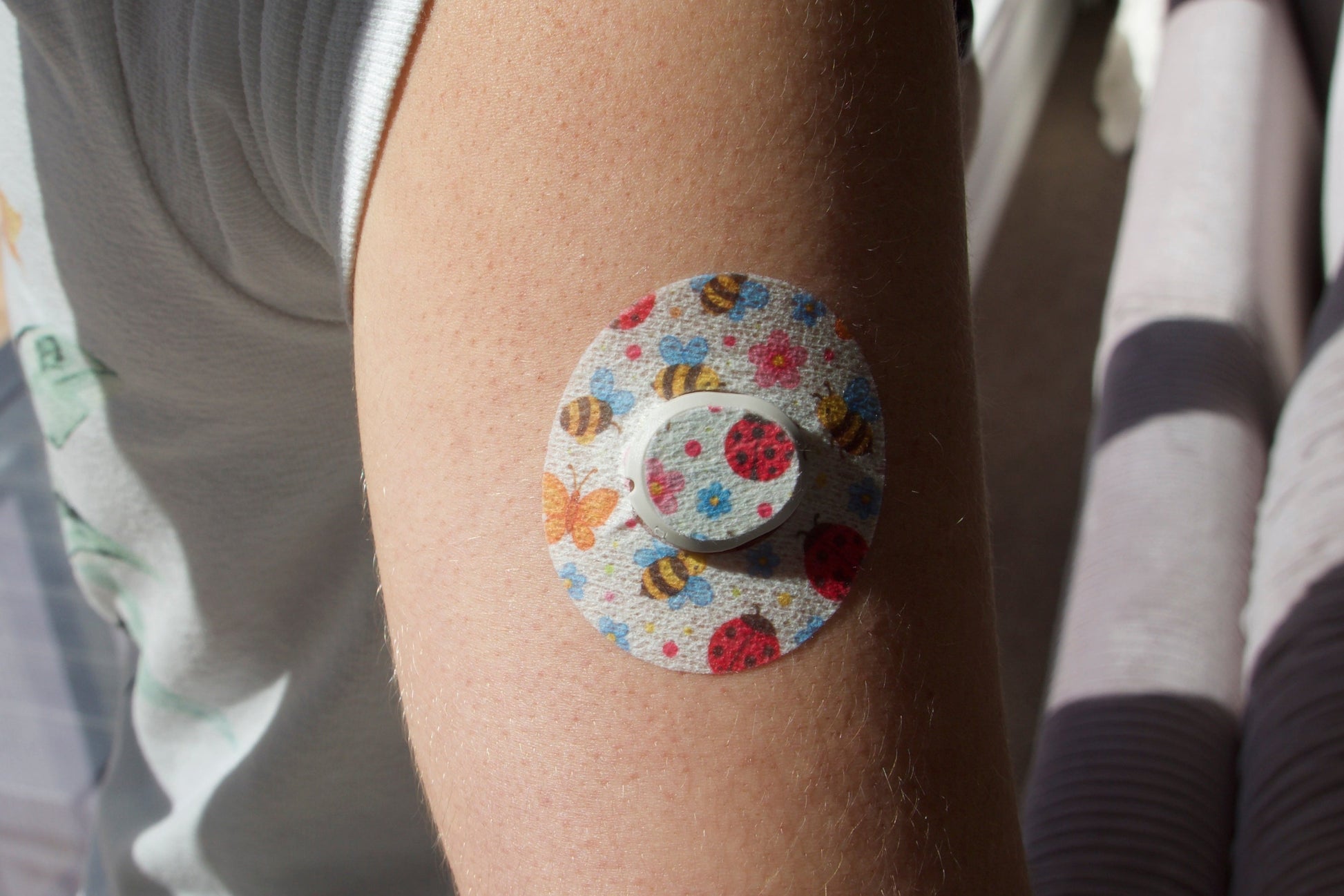 CGM patch .Bugs and Butterflies . Upper arm. Dexcom One + device.