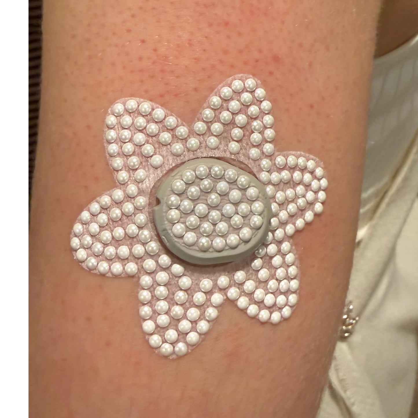 Photo of upper arm with Decorative costume jewellery pearl-look G7 CGM patch