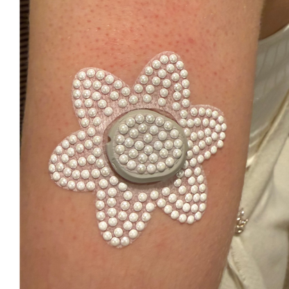 Photo of upper arm with Decorative costume jewellery pearl-look G7 CGM patch